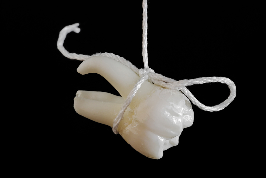 The Comprehensive Guide to Tooth Extraction: What to Expect and How to Prepare