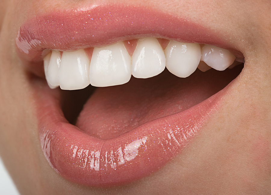 Enhancing Your Smile with Cosmetic Procedures in Morristown, NJ