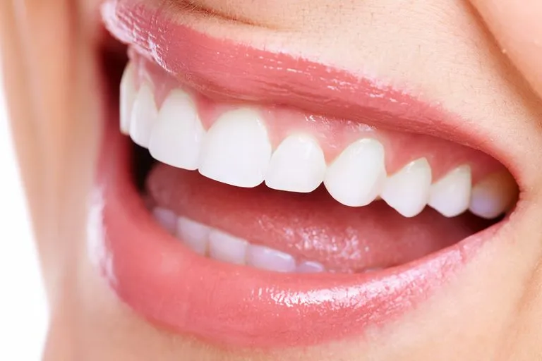 Transforming Smiles: How Dental Implants Strengthen Jawbone Health and Enhance Facial Aesthetics