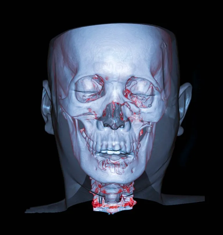 Comprehensive Care for Facial Trauma in Morristown, NJ: Restoring Function and Aesthetics